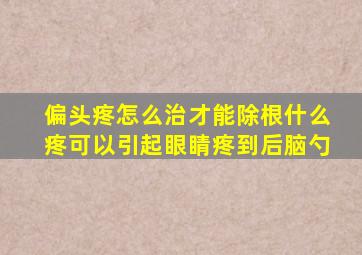 偏头疼怎么治才能除根什么疼可以引起眼睛疼到后脑勺